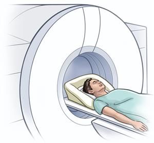 MRI Scan MRI Scan