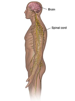 Lou Gehrig's Disease - Amyotrophic Lateral Sclerosis